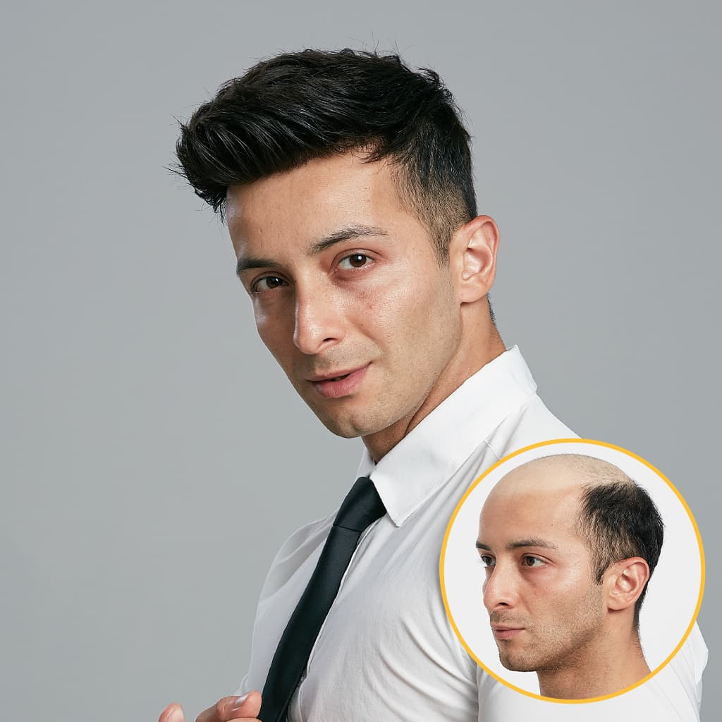 D7-5 Men's Lace Toupee With NPU Perimeter in Stock Wholesale thumbnail 4