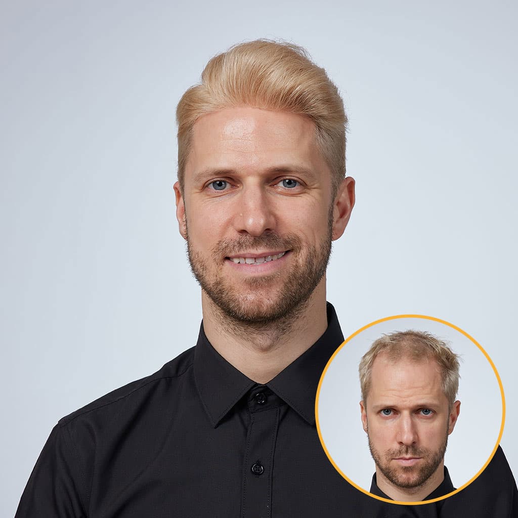 HS1R  Thin Skin Men's Toupee Hair Systems 0.08 mm Remy Hair Transparent Poly Skin thumbnail 15