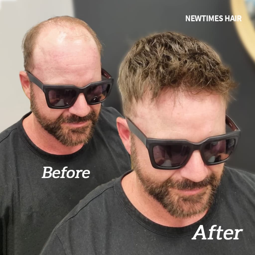 INS  Thin Skin Hair Piece for Men Wholesale Injected PU Skin Base thumbnail 6