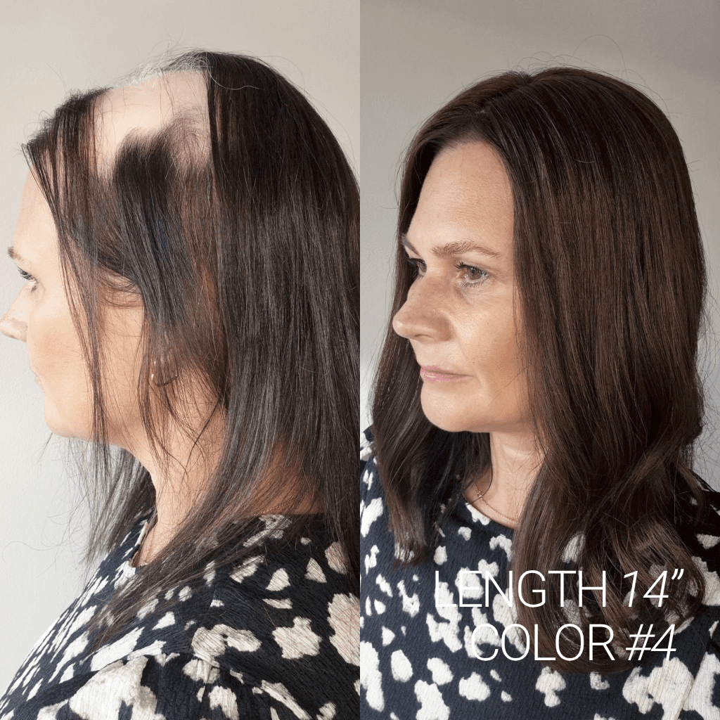 ORPHA Top-Tier Silk Top Topper With Cuticle-Aligned Mongolian Hair thumbnail 10